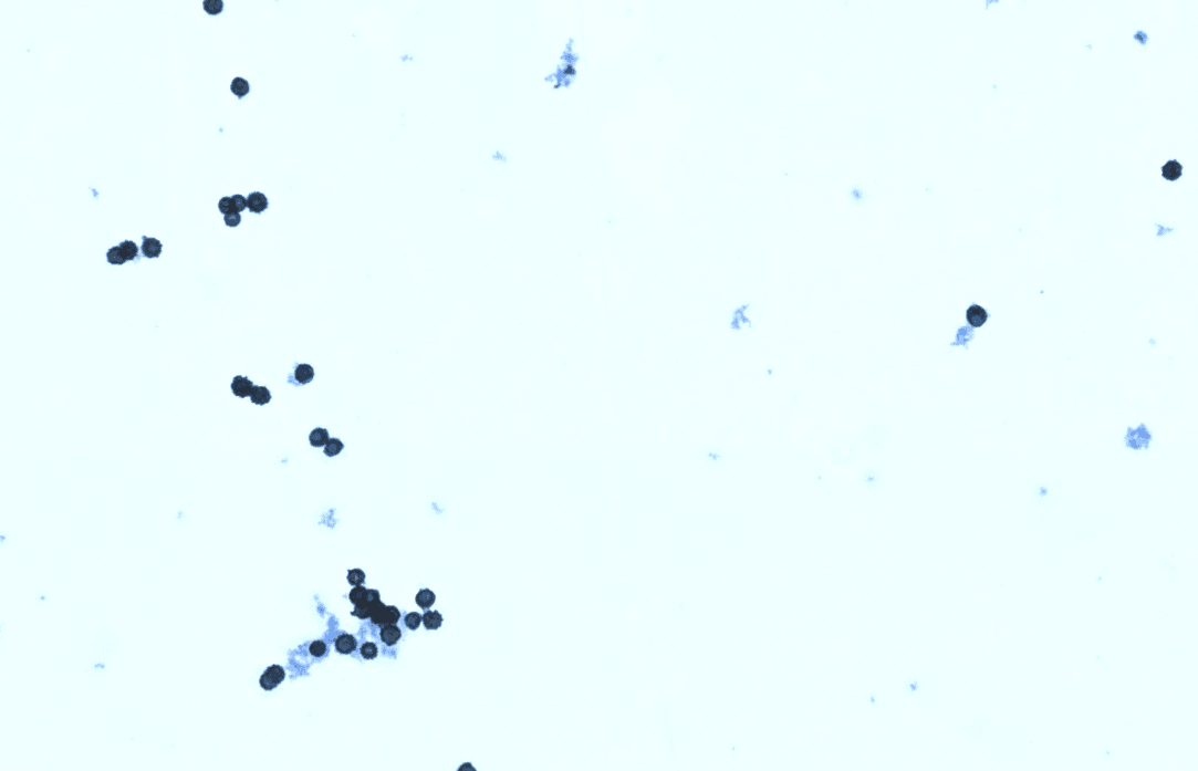 Detailed spore analysis with AI classification