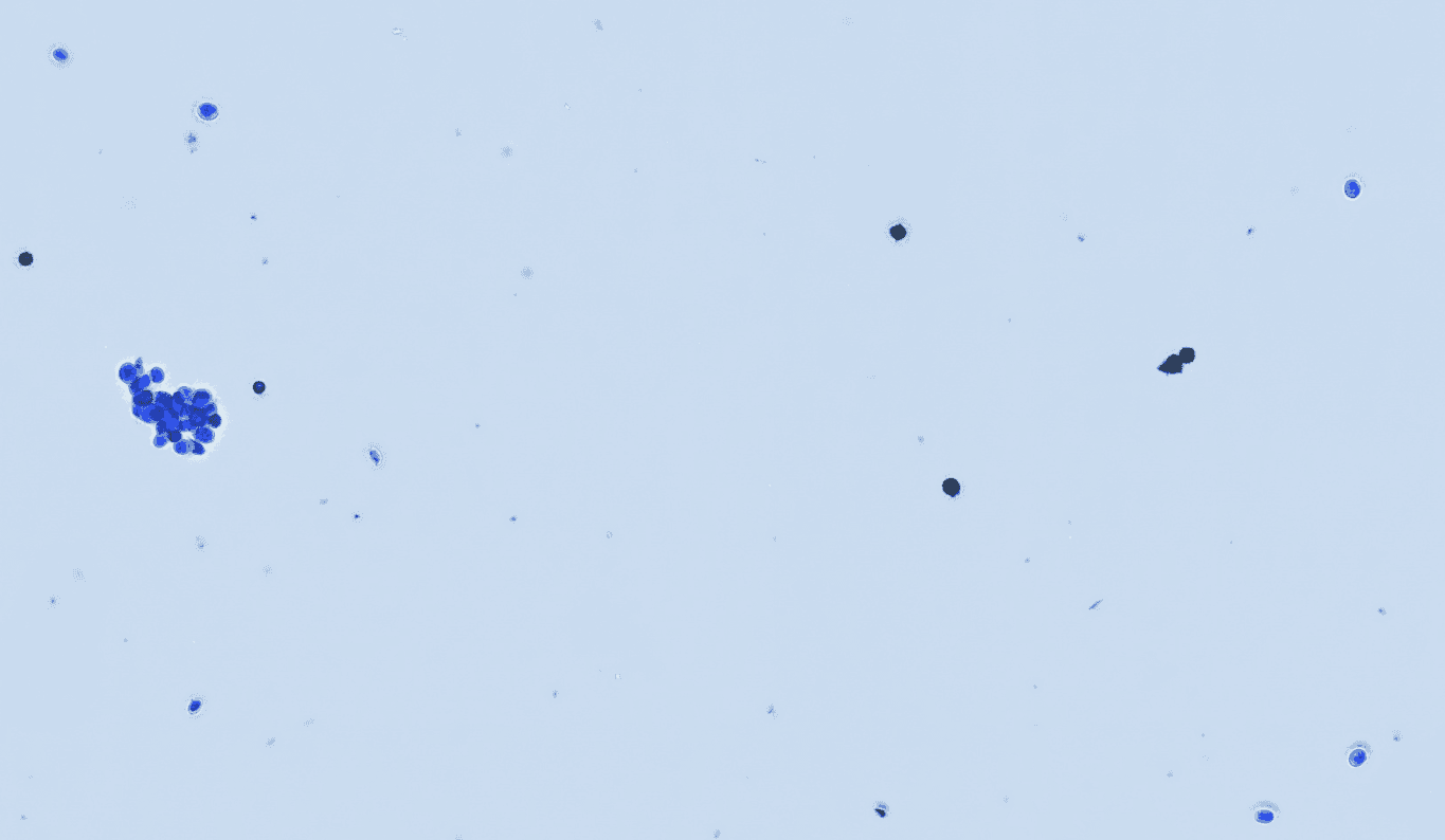 Yeast and mold detection via digital whole-slide imaging